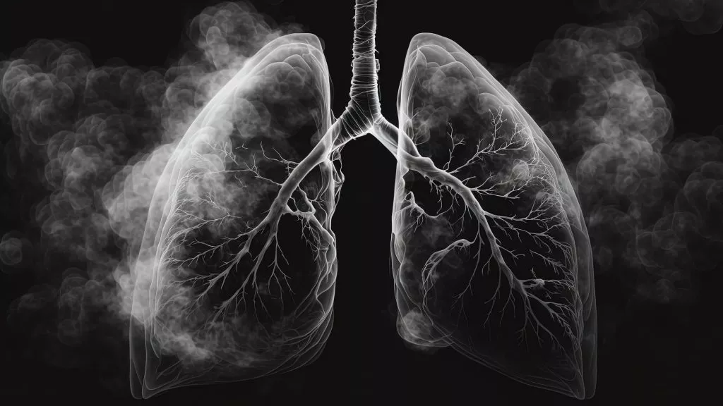 Instituto Mário Penna faz alerta no mês de combate ao câncer de pulmão