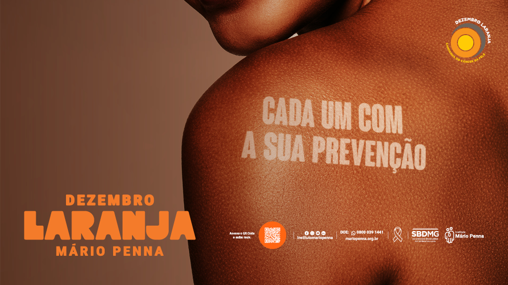 Dezembro Laranja: Mário Penna e Sociedade Brasileira de Dermatologia se unem e realizam atendimento gratuito para orientação e diagnóstico do câncer de pele