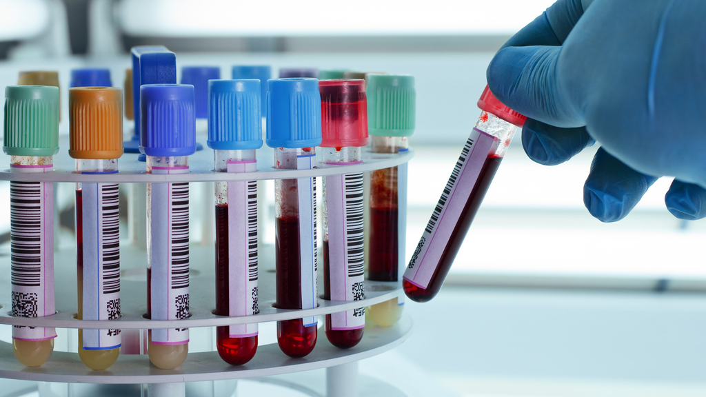 Dia Mundial de Conscientização dos Cânceres do Sangue: ciência em busca de um cuidado mais personalizado